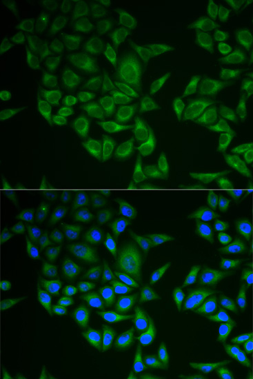 Anti-CD3 zeta antibody (ab190728) | Abcam