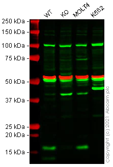 Anti-CD3 zeta antibody (ab190728) | Abcam