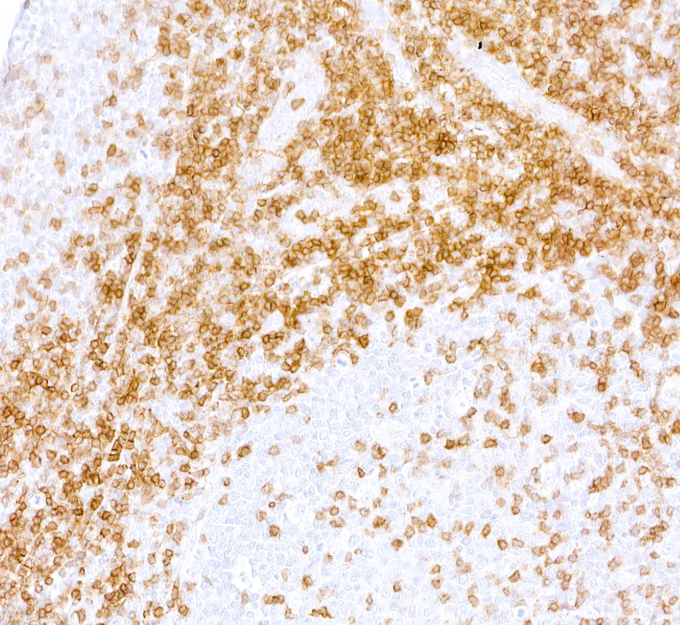 Immunohistochemistry (Formalin/PFA-fixed paraffin-embedded sections) - Anti-CD3 zeta antibody [BL-336-1B2] (AB243874)