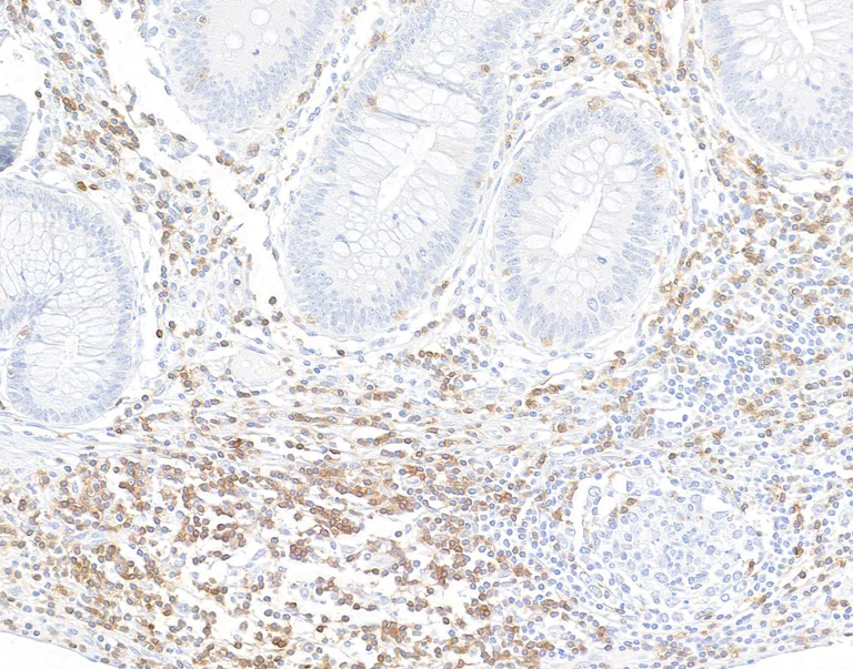 Anti-CD3 zeta antibody [BL-336-1B2] (ab243874) | Abcam