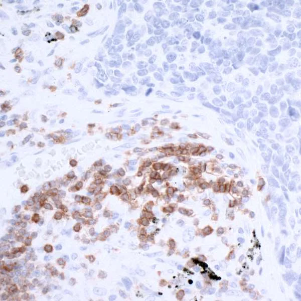 Immunohistochemistry (Formalin/PFA-fixed paraffin-embedded sections) - Anti-CD3 zeta antibody [BL-336-1B2] - BSA free (AB272071)