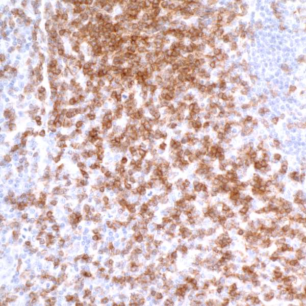 Immunohistochemistry (Formalin/PFA-fixed paraffin-embedded sections) - Anti-CD3 zeta antibody [BL-336-1B2] - BSA free (AB272071)