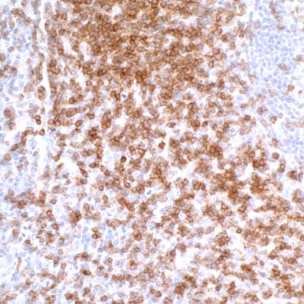 Immunohistochemistry (Formalin/PFA-fixed paraffin-embedded sections) - Anti-CD3 zeta antibody [BL-336-1B2] - BSA free (AB272071)