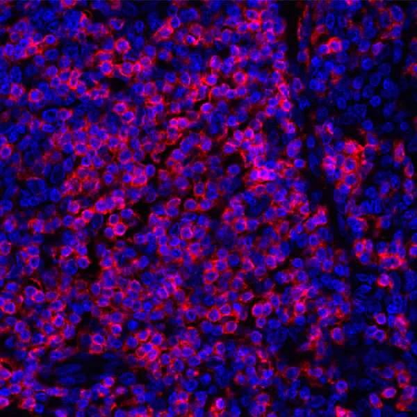 Immunohistochemistry (Formalin/PFA-fixed paraffin-embedded sections) - Anti-CD3 zeta antibody [BL-336-1B2] - BSA free (AB272071)