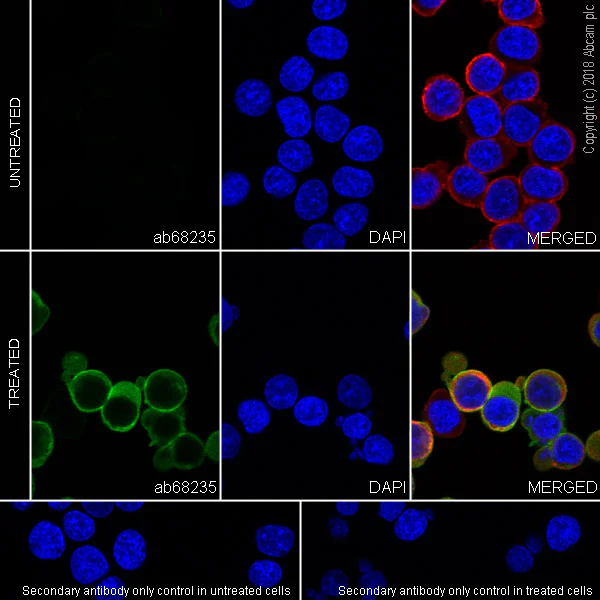 Anti-CD3 zeta (phospho Y142) antibody [EP265(2)Y] (ab68235) | Abcam
