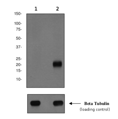 Anti-CD3 zeta (phospho Y83) antibody [EP776(2)Y] (ab68236) | Abcam
