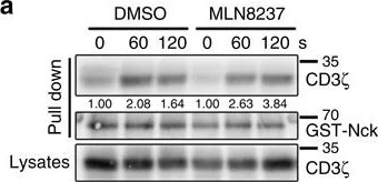 Western blot - Anti-CD3 zeta (phospho Y83) antibody [EP776(2)Y] (AB68236)