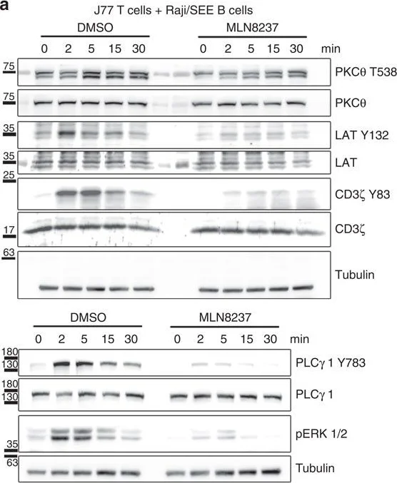 Western blot - Anti-CD3 zeta (phospho Y83) antibody [EP776(2)Y] (AB68236)