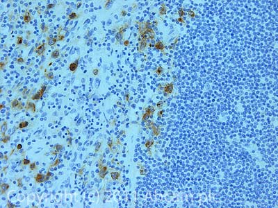 Immunohistochemistry (Formalin/PFA-fixed paraffin-embedded sections) - Anti-CD30 antibody [Ber-H2], prediluted (AB871), expandable thumbnail