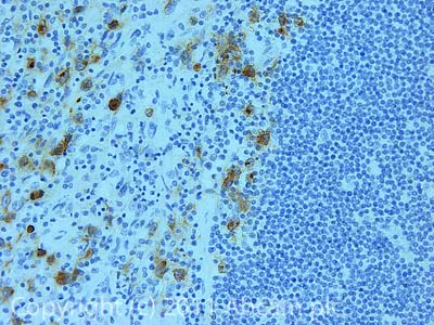Immunohistochemistry (Formalin/PFA-fixed paraffin-embedded sections) - Anti-CD30 antibody [Ber-H2], prediluted (AB871)