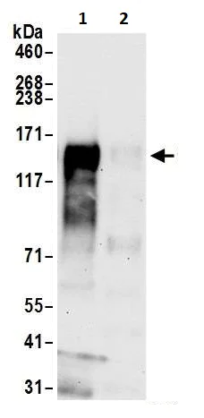 Immunoprecipitation - Anti-CD30 antibody [BLR055F] (AB252561)