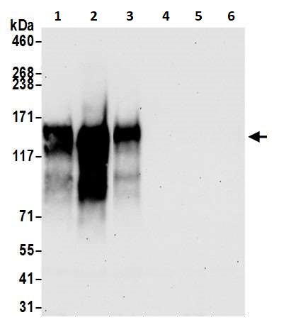 Western blot - Anti-CD30 antibody [BLR055F] (AB252561), expandable thumbnail