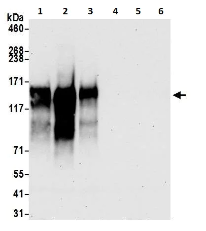 Western blot - Anti-CD30 antibody [BLR055F] (AB252561)