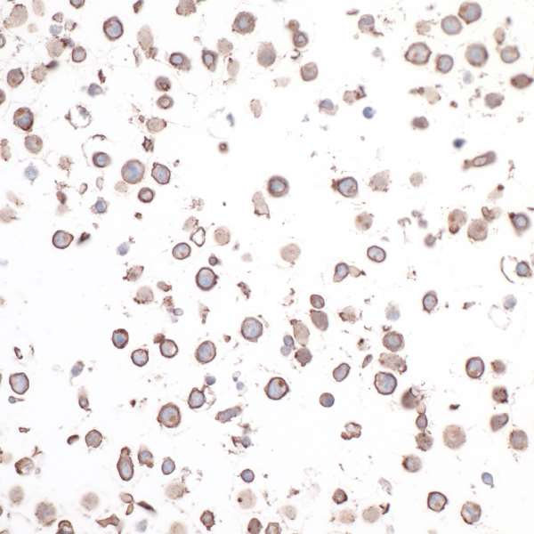 Immunocytochemistry - Anti-CD30 antibody [BLR055F] - BSA free (AB272089), expandable thumbnail