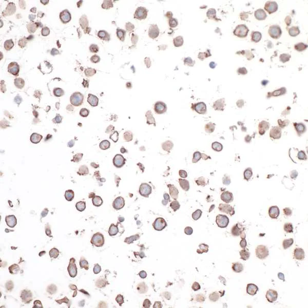 Immunocytochemistry - Anti-CD30 antibody [BLR055F] - BSA free (AB272089)