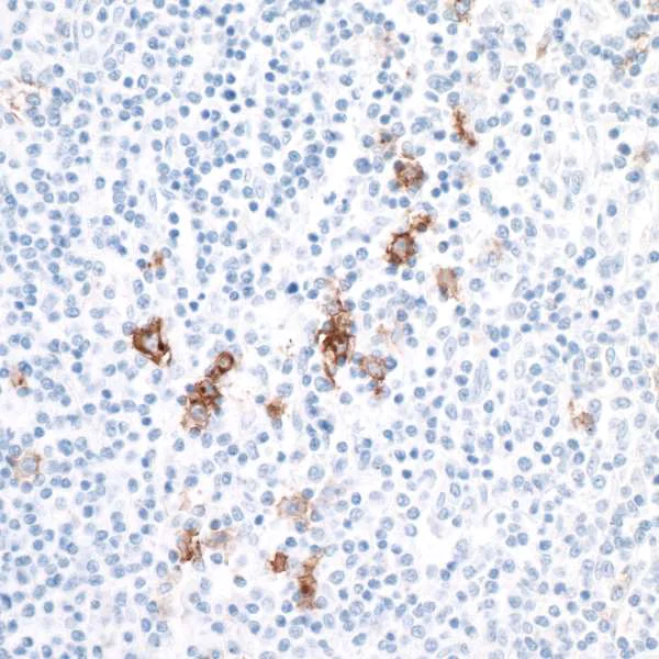 Immunohistochemistry (Formalin/PFA-fixed paraffin-embedded sections) - Anti-CD30 antibody [BLR055F] - BSA free (AB272089)