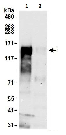 Immunoprecipitation - Anti-CD30 antibody [BLR055F] - BSA free (AB272089), expandable thumbnail