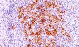 Immunohistochemistry (Formalin/PFA-fixed paraffin-embedded sections) - Anti-CD30 antibody [CD30/412] (AB187367)