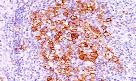 Immunohistochemistry (Formalin/PFA-fixed paraffin-embedded sections) - Anti-CD30 antibody [CD30/412] (AB187367)