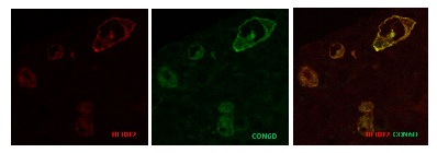 Immunocytochemistry/ Immunofluorescence - Anti-CD30 antibody [CON6D/B5] (AB23766), expandable thumbnail
