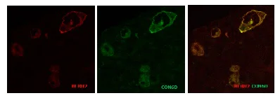 Immunocytochemistry/ Immunofluorescence - Anti-CD30 antibody [CON6D/B5] (AB23766)