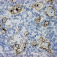 Immunohistochemistry (Formalin/PFA-fixed paraffin-embedded sections) - Anti-CD30 antibody [CON6D/B5] (AB23766)