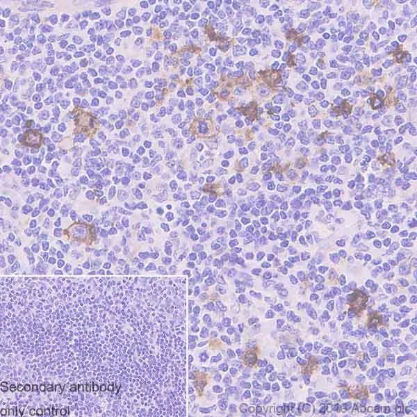 Immunohistochemistry (Formalin/PFA-fixed paraffin-embedded sections) - Anti-CD30 antibody [EPR4102] (AB134080)