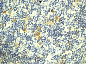 Immunohistochemistry (Formalin/PFA-fixed paraffin-embedded sections) - Anti-CD30 antibody [EPR4102] (AB134080)