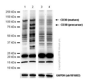 Western blot - Anti-CD30 antibody [EPR4102] (AB134080)