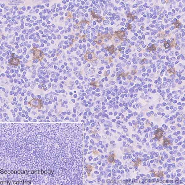 Immunohistochemistry (Formalin/PFA-fixed paraffin-embedded sections) - Anti-CD30 antibody [EPR4102] - BSA and Azide free (AB210850)