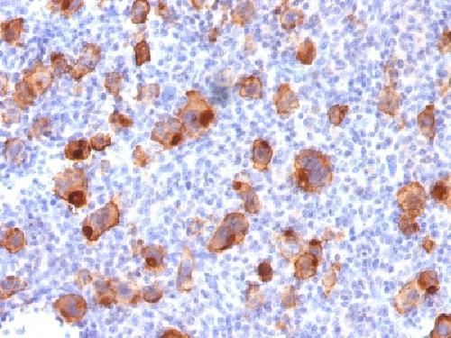 Immunohistochemistry (Formalin/PFA-fixed paraffin-embedded sections) - Anti-CD30 antibody [rKi-1/779] (AB219330), expandable thumbnail