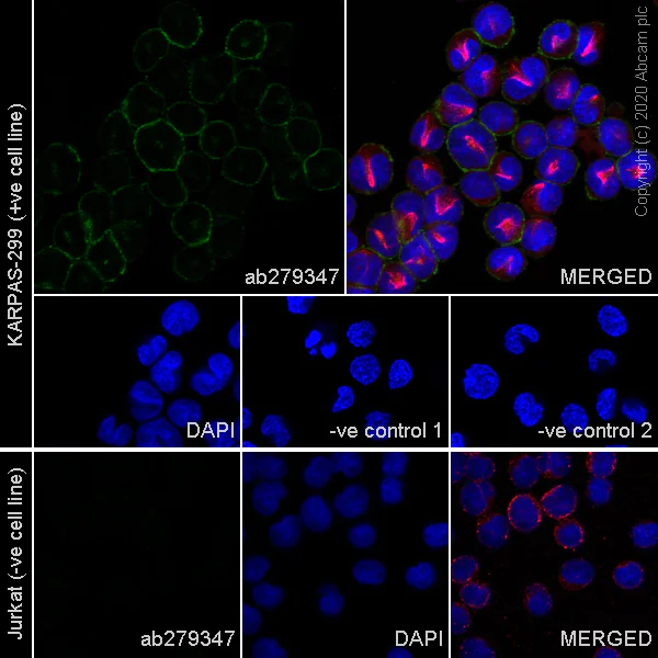 Immunocytochemistry/ Immunofluorescence - Anti-CD30 antibody [SH313-B5] - Mouse IgG2a (Chimeric) (AB279347)