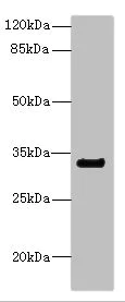 Western blot - Anti-CD300a antibody (AB230339)