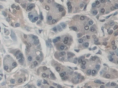 Immunohistochemistry (Formalin/PFA-fixed paraffin-embedded sections) - Anti-CD300C antibody (AB232789)