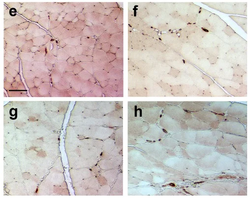 Immunohistochemistry (Formalin/PFA-fixed paraffin-embedded sections) - Anti-CD31 antibody (AB124432)