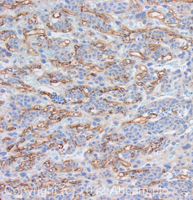 Immunohistochemistry (Formalin/PFA-fixed paraffin-embedded sections) - Anti-CD31 antibody (AB124432)