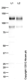 Western blot - Anti-CD31 antibody (AB124432)