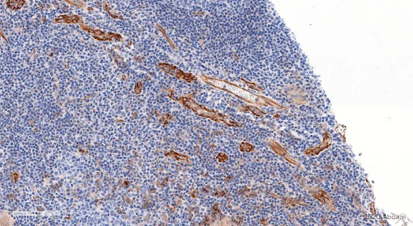 Immunohistochemistry (Formalin/PFA-fixed paraffin-embedded sections) - Anti-CD31 antibody (AB28364)