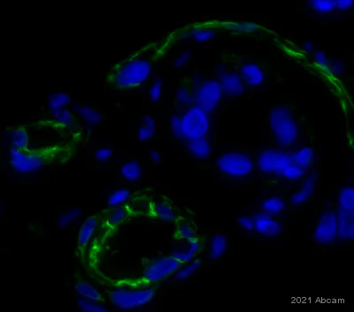 Immunohistochemistry (Formalin/PFA-fixed paraffin-embedded sections) - Anti-CD31 antibody (AB28364)