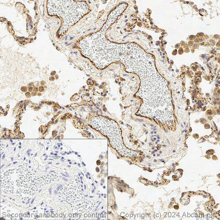 Immunohistochemistry (Formalin/PFA-fixed paraffin-embedded sections) - Anti-CD31 antibody (AB28364)