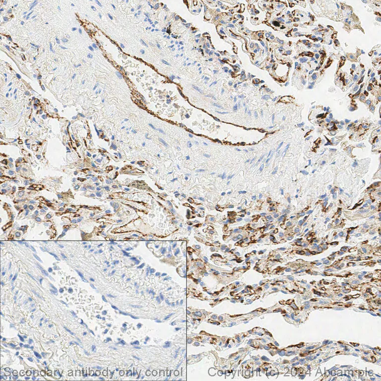 Immunohistochemistry (Formalin/PFA-fixed paraffin-embedded sections) - Anti-CD31 antibody (AB28364)