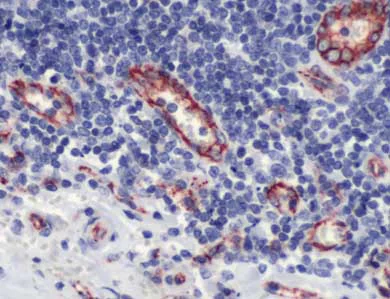 Immunohistochemistry (Formalin/PFA-fixed paraffin-embedded sections) - Anti-CD31 antibody (AB28364)
