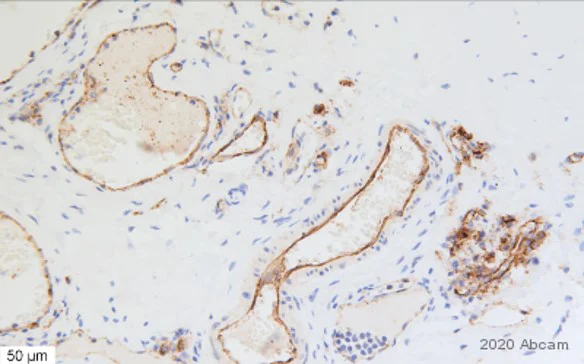 Immunohistochemistry (Formalin/PFA-fixed paraffin-embedded sections) - Anti-CD31 antibody (AB28364)