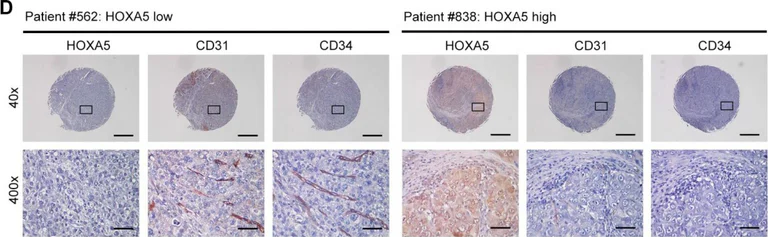 Immunohistochemistry - Anti-CD31 antibody (AB28364)