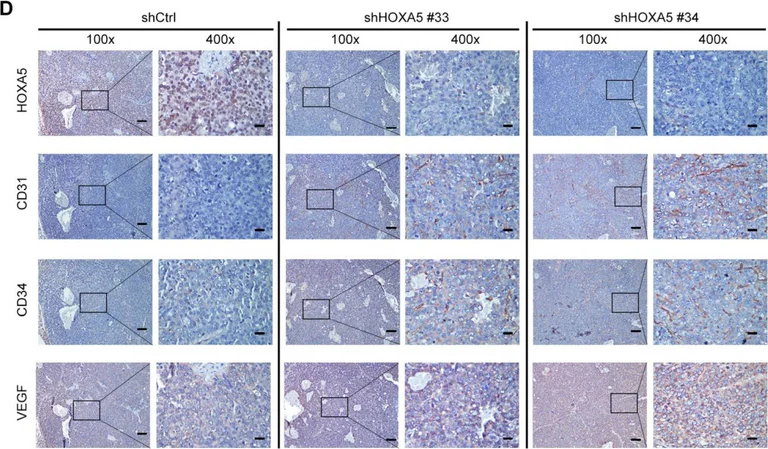 Immunohistochemistry - Anti-CD31 antibody (AB28364)