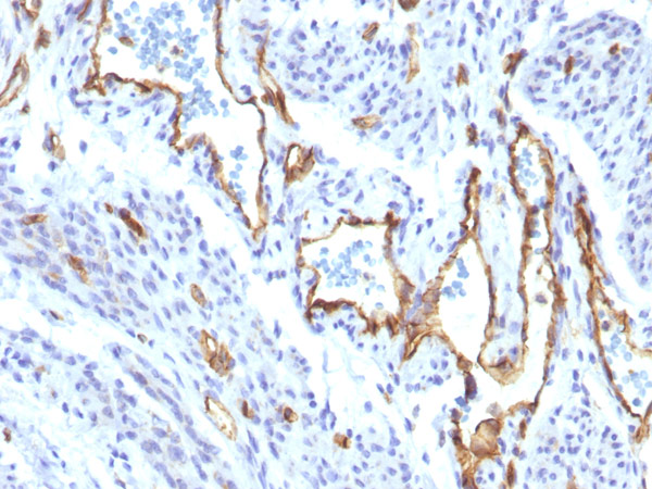 Immunohistochemistry (Formalin/PFA-fixed paraffin-embedded sections) - Anti-CD31 antibody [C31/1395R] (AB218477), expandable thumbnail
