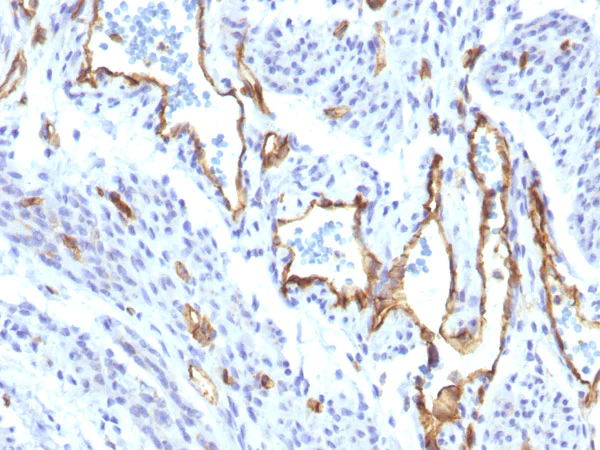 Immunohistochemistry (Formalin/PFA-fixed paraffin-embedded sections) - Anti-CD31 antibody [C31/1395R] (AB218477)