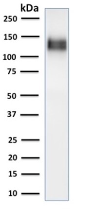 Western blot - Anti-CD31 antibody [C31/1395R] (AB218477), expandable thumbnail