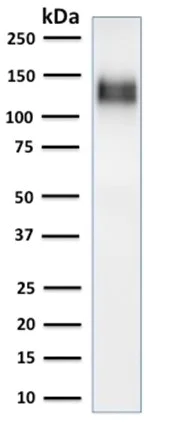 Western blot - Anti-CD31 antibody [C31/1395R] (AB218477)