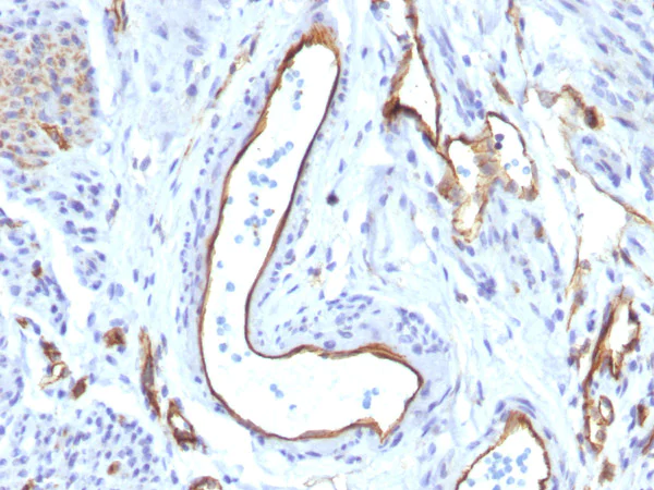 Immunohistochemistry (Formalin/PFA-fixed paraffin-embedded sections) - Anti-CD31 antibody [C31/1395R] - BSA and Azide free (AB218932)